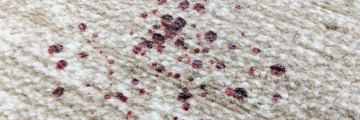 How to Remove Blood Stains From Carpet